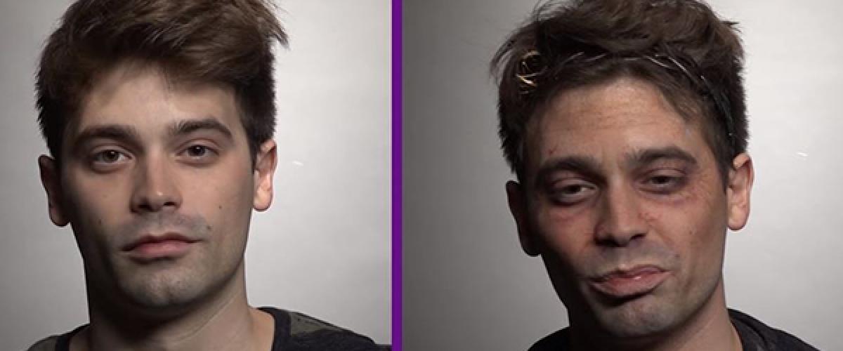 Before And After Drugs